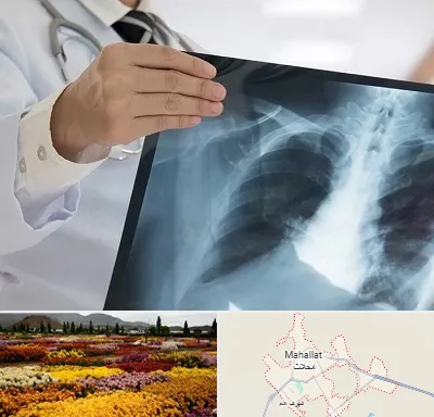فوق تخصص ریه در محلات