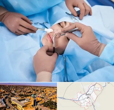 عمل بینی فانتزی در بافق