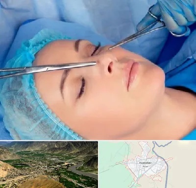 عمل بینی نیمه فانتزی در اسدآباد