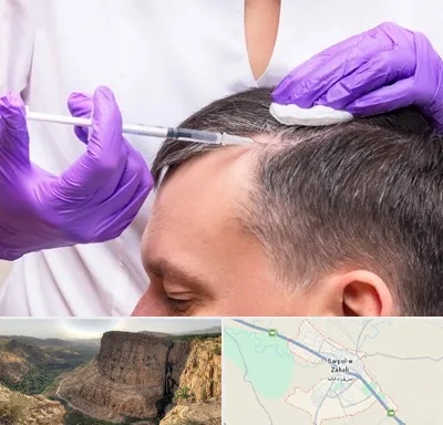 دکتر فوق تخصص پوست و مو در سرپل ذهاب