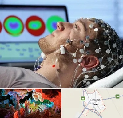 مرکز نوار مغز در دلیجان