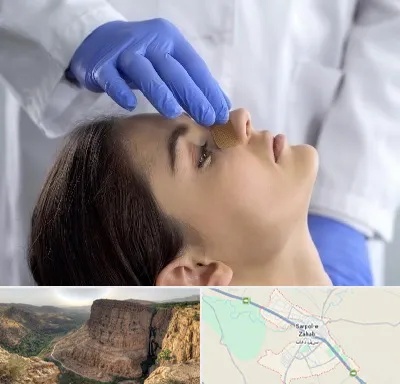 عمل بینی عروسکی در سرپل ذهاب