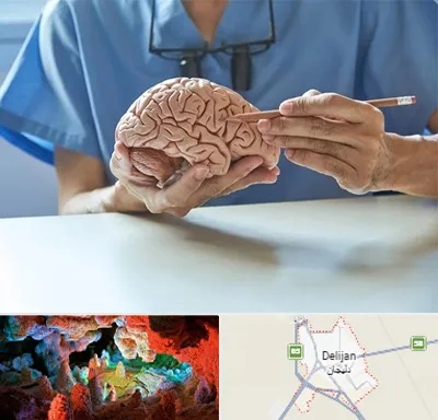 دکتر نورولوژی در دلیجان