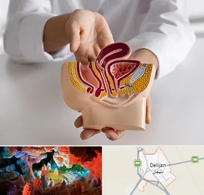 دکتر دستگاه تناسلی مردان در دلیجان