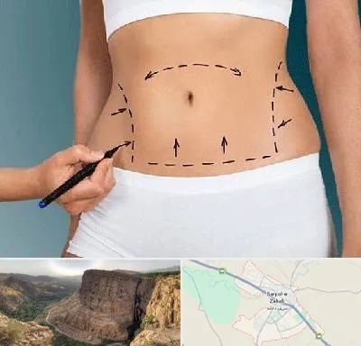 دکتر طب سنتی برای لاغری در سرپل ذهاب