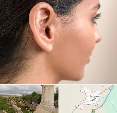 عمل گوش بل در کنگاور