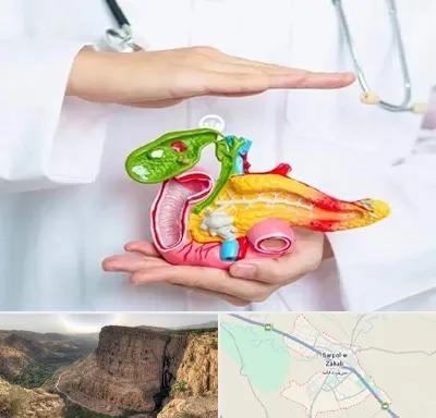 دکتر سرطان لوزالمعده در سرپل ذهاب