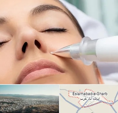 پلاسما جت بینی در اسلام آباد غرب