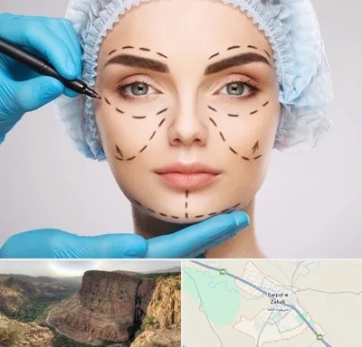 جراح پلاستیک در سرپل ذهاب