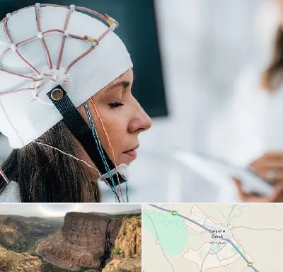 آزمایشگاه نقشه برداری مغز در سرپل ذهاب