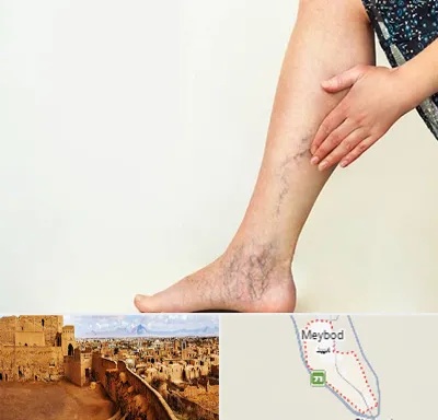 دکتر واریس در میبد