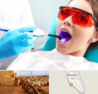 جراحی لثه با لیزر در میبد