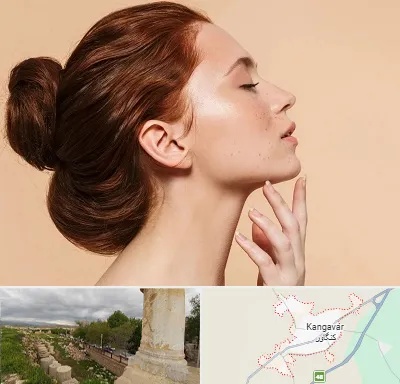جراحی غبغب در کنگاور