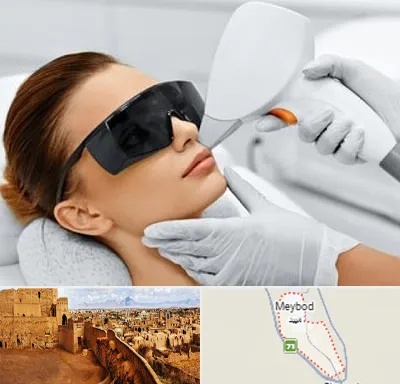 مرکز لیزر مو در میبد