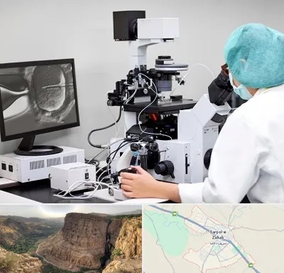 آزمایشگاه اسپرموگرام در سرپل ذهاب