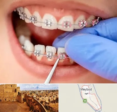 مرکز ارتودنسی دندان در میبد