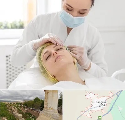 کلینیک زیبایی در کنگاور