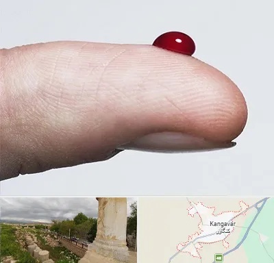 مرکز فصد خون در کنگاور