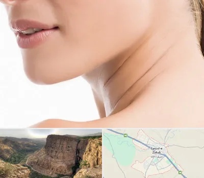 جراحی فک با لیزر در سرپل ذهاب