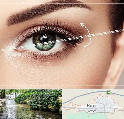 جراحی چشم گربه ای در هرسین