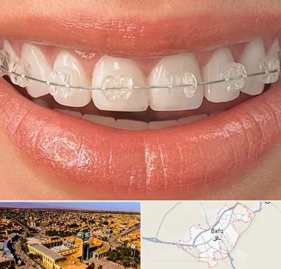 ارتودنسی اقساطی در بافق