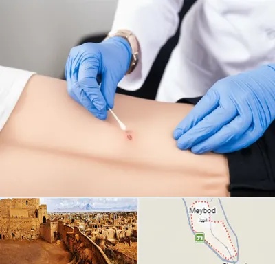 متخصص زخم بستر در میبد