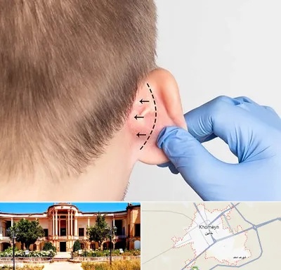 عمل زیبایی گوش در خمین