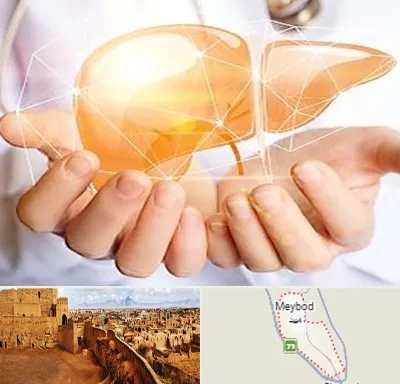 دکتر سرطان کبد در میبد