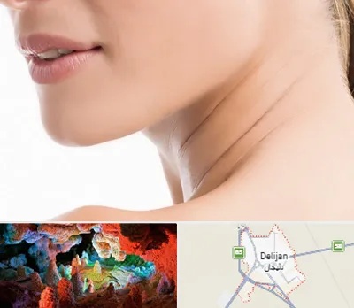 جراحی فک با لیزر در دلیجان