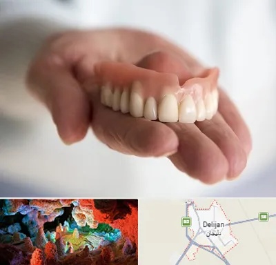 لیفت لثه با لیزر در دلیجان
