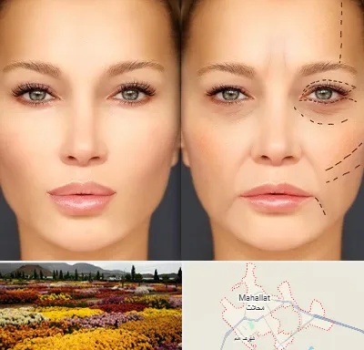 متخصص زیبایی چشم در محلات