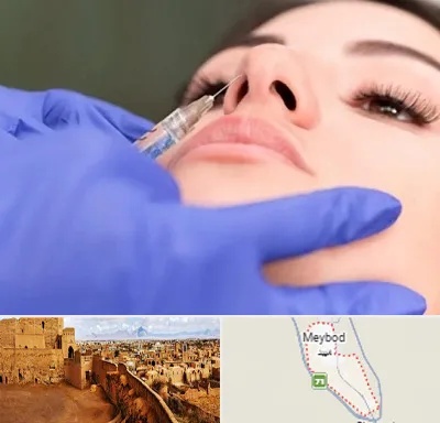 هیالاز در میبد