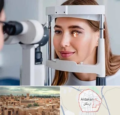 دکتر قوز قرنیه در اردکان