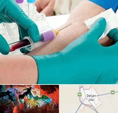 آزمایشگاه در منزل در دلیجان