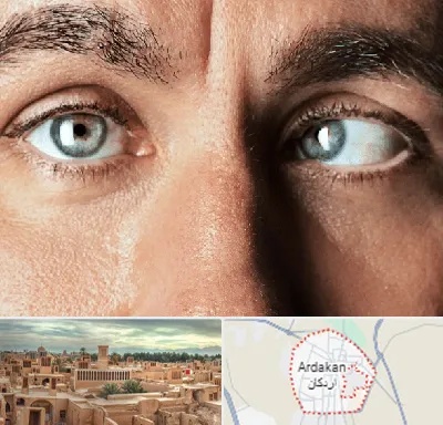فوق تخصص استرابیسم در اردکان