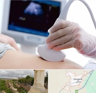 سونوگرافی در کنگاور