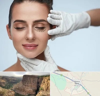 عمل پف چشم در سرپل ذهاب