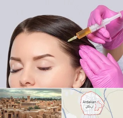 تزریق هیر فیلر در اردکان