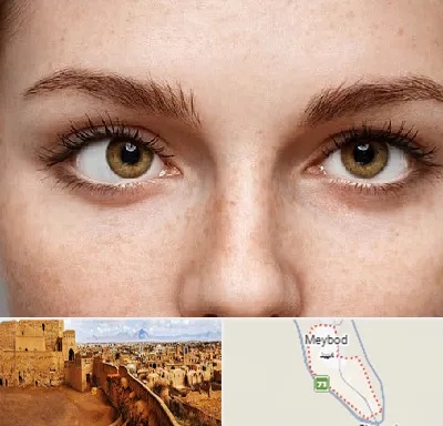 متخصص انحراف چشم در میبد