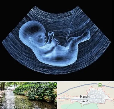 دکتر متخصص غربال گری در هرسین