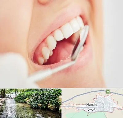 اصلاح طرح لبخند در هرسین