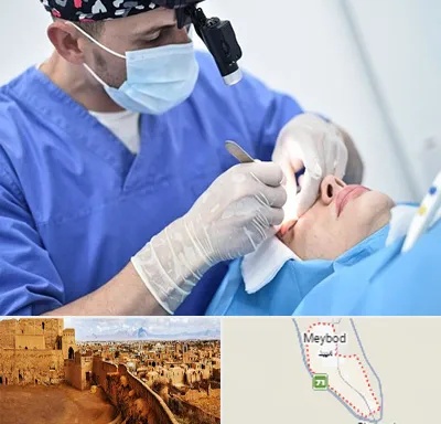 جراح سرطان چشم در میبد