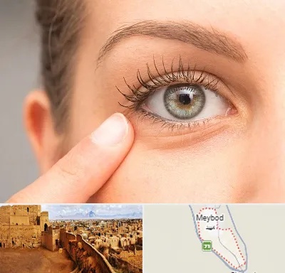 جراح پف چشم در میبد