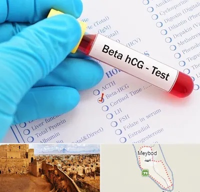 آزمایشگاه بارداری در میبد