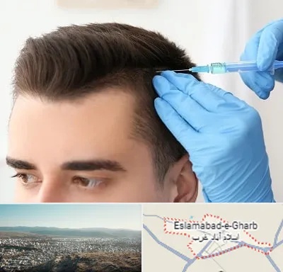 مزوتراپی مو در اسلام آباد غرب
