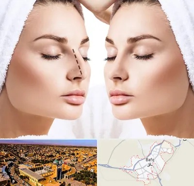 عمل بینی در بافق