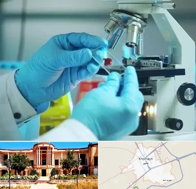 آزمایشگاه با جواب فوری در خمین