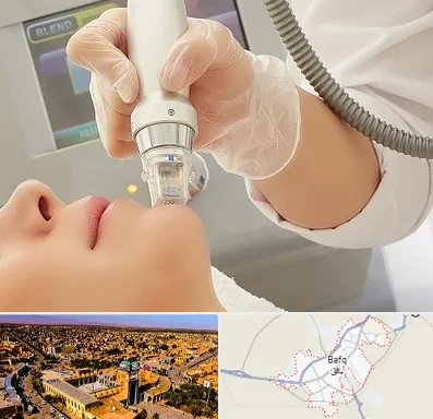 آر اف فرکشنال در بافق