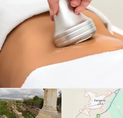 دستگاه لاغری در کنگاور