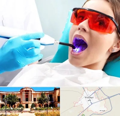 جراحی لثه با لیزر در خمین